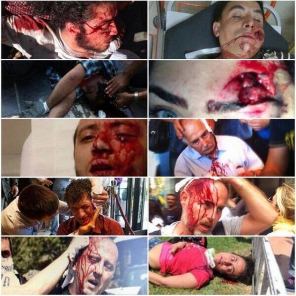 http://www.islamicinvitationturkey.com/wp-content/uploads/2013/06/this-is-police-brutality-in-Turkey-occupygezi.jpg