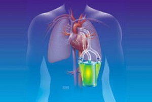 artificial-lung