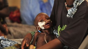 360796_Sahel-malnutrition