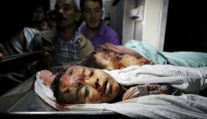 In Picture: Israeli-made agony for Gaza children