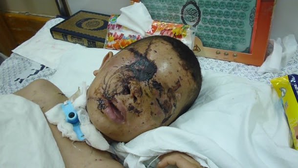 9-year-old-palestinian-badly-injured-2014